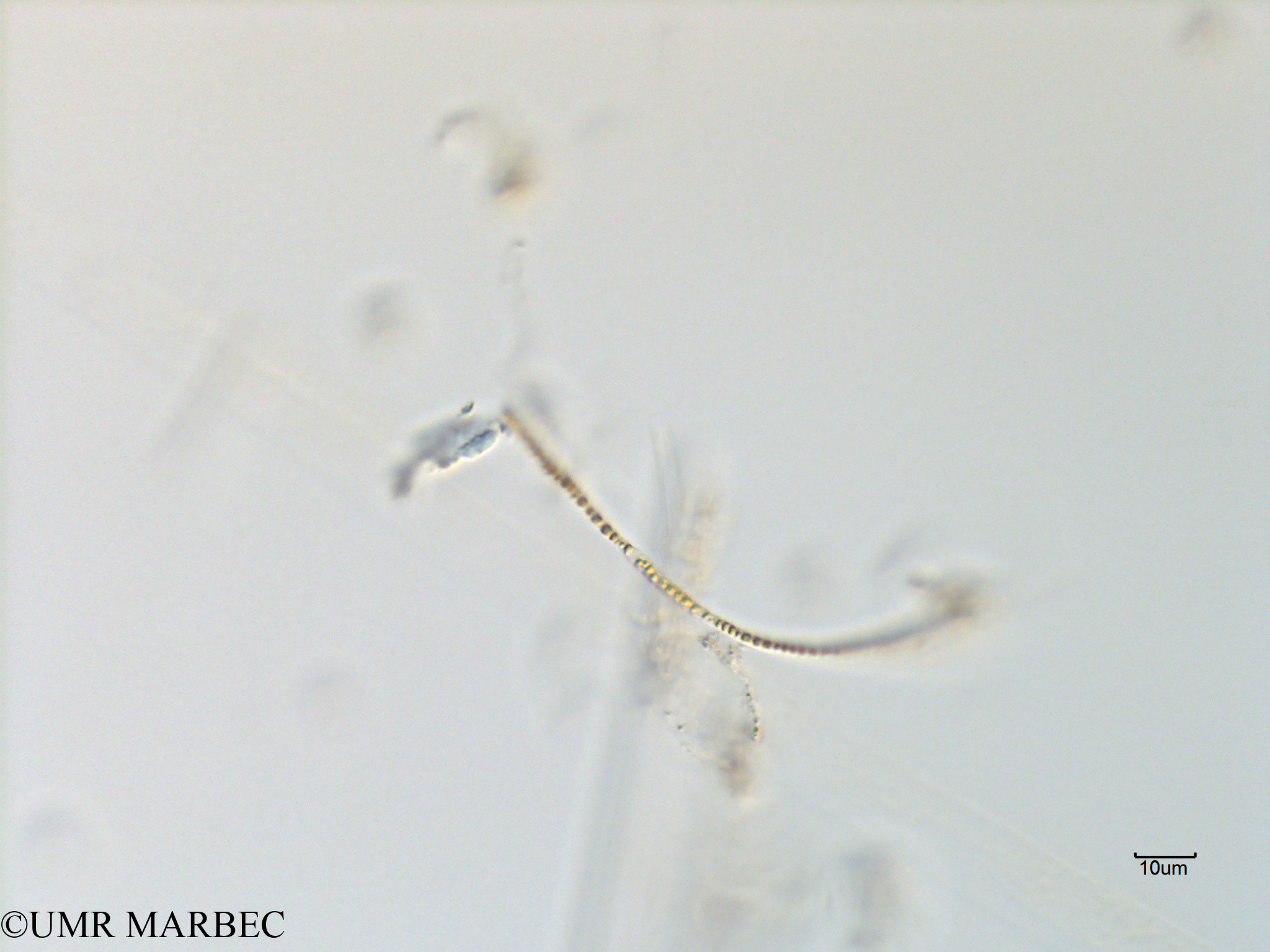 phyto/Scattered_Islands/mayotte_lagoon/SIREME May 2016/Oscillatoriale spp (MAY11_cyano2-2).tif(copy).jpg